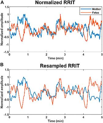 Similarities between maternal and fetal RR interval tachograms and their association with fetal development